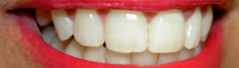 teethwoman