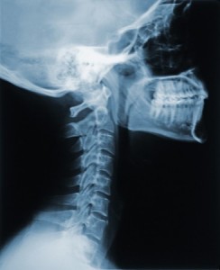 This is an X-ray of the neck