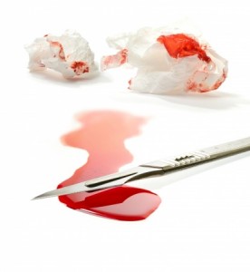 Concept stock image for clinical negligence or clinical malpractice
