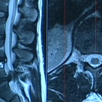 Reading an MRI