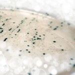 Agar plate with bacterial colonies transformed with plasmid DNA