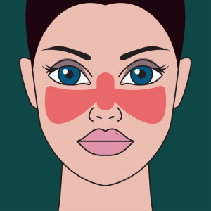 99323043 - systemic lupus erythematosus